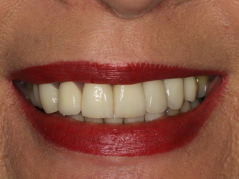 Home Matrix Dental Specialists Dentist Cape Town