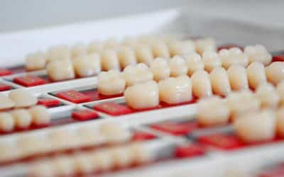 What Are The Different Types Of Veneers