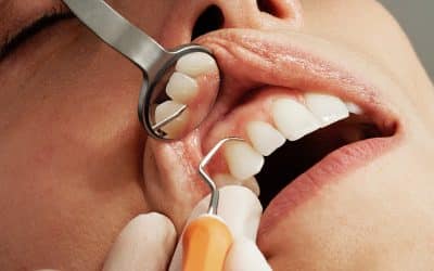 Advantages & Dental Implants Can go Wrong